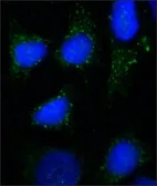 Anti-RAB7A antibody [Rab7-117] used in Immunocytochemistry/ Immunofluorescence (ICC/IF). GTX16196