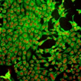 Anti-Glutathione antibody [D8] used in Immunocytochemistry/ Immunofluorescence (ICC/IF). GTX16200