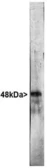 Anti-NeuN antibody used in Western Blot (WB). GTX16208