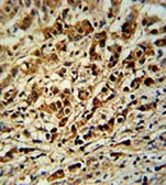 Anti-AVL9 antibody used in IHC (Paraffin sections) (IHC-P). GTX16209