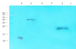 Anti-CGRP antibody used in Western Blot (WB). GTX16211