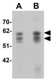 Anti-CCDC55 antibody used in Western Blot (WB). GTX16250