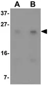 Anti-LY6K antibody used in Western Blot (WB). GTX16304