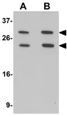 Anti-MS4A6A antibody used in Western Blot (WB). GTX16310