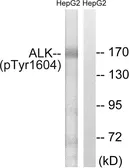 Anti-ALK (phospho Tyr1604) antibody used in Western Blot (WB). GTX16377