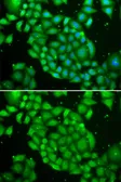 Anti-TCL1A antibody used in Immunocytochemistry/ Immunofluorescence (ICC/IF). GTX16378