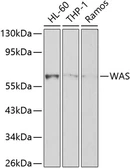 Anti-WASP antibody used in Western Blot (WB). GTX16382