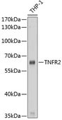 Anti-TNF Receptor II antibody used in Western Blot (WB). GTX16384