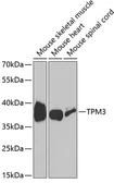 Anti-Tropomyosin 3 antibody used in Western Blot (WB). GTX16386