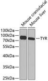 Anti-Tyrosinase antibody used in Western Blot (WB). GTX16389