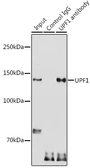 Anti-RENT1 antibody used in Immunoprecipitation (IP). GTX16390