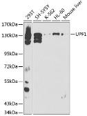 Anti-RENT1 antibody used in Western Blot (WB). GTX16390
