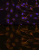 Anti-TIMP2 antibody used in Immunocytochemistry/ Immunofluorescence (ICC/IF). GTX16392