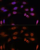 Anti-Thyroid Hormone Receptor beta antibody used in Immunocytochemistry/ Immunofluorescence (ICC/IF). GTX16393