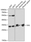 Anti-TFPI antibody used in Western Blot (WB). GTX16395
