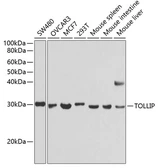 Anti-Tollip antibody used in Western Blot (WB). GTX16406