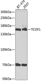 Anti-TCOF1 antibody used in Western Blot (WB). GTX16408