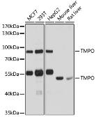 Anti-LAP2 antibody used in Western Blot (WB). GTX16410