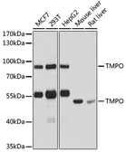 Anti-LAP2 antibody used in Western Blot (WB). GTX16410