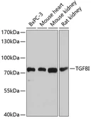Anti-TGFBI antibody used in Western Blot (WB). GTX16415