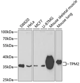 Anti-Tropomyosin 2 antibody used in Western Blot (WB). GTX16425