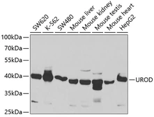 Anti-UROD antibody used in Western Blot (WB). GTX16432