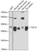Anti-TCF19 antibody used in Western Blot (WB). GTX16440