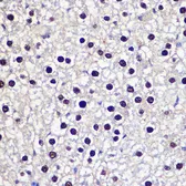 Anti-Transketolase antibody used in IHC (Paraffin sections) (IHC-P). GTX16442