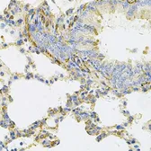 Anti-UBE2B antibody used in IHC (Paraffin sections) (IHC-P). GTX16443