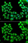 Anti-TIMP4 antibody used in Immunocytochemistry/ Immunofluorescence (ICC/IF). GTX16463