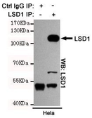 Anti-LSD1 antibody [1E5-H2] used in Immunoprecipitation (IP). GTX16471