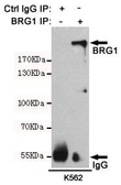 Anti-BRG1 antibody [4E11-E11-G11] used in Immunoprecipitation (IP). GTX16472