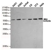 Anti-RAD23B antibody [5H1-A10-A7] used in Western Blot (WB). GTX16485