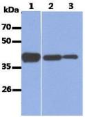 Anti-Aldolase A antibody [AT3F9] used in Western Blot (WB). GTX16497