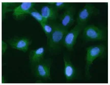 Anti-Cytokeratin 20 antibody [AT10D8] used in Immunocytochemistry/ Immunofluorescence (ICC/IF). GTX16500