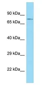 Anti-ACSBG1 antibody, N-term used in Western Blot (WB). GTX16561