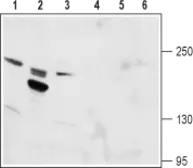 Anti-TRPM6 antibody used in Western Blot (WB). GTX16611