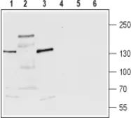 Anti-TRPM3 antibody used in Western Blot (WB). GTX16612