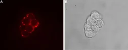 Anti-TRPC7 antibody used in Live cell imaging (LCI). GTX16614