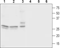 Anti-Cav gamma 3 antibody used in Western Blot (WB). GTX16621