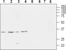 Anti-Cav gamma 4 antibody used in Western Blot (WB). GTX16625