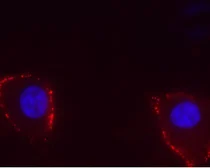 Anti-TRPV4 antibody used in Live cell imaging (LCI). GTX16630