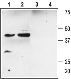 Anti-KCNMB2 antibody used in Western Blot (WB). GTX16645