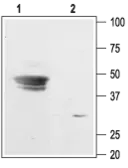 Anti-KCNJ9 antibody used in Western Blot (WB). GTX16648