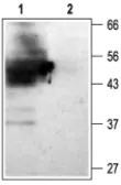 Anti-KCNJ15 antibody used in Western Blot (WB). GTX16664