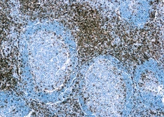 Anti-CD3 antibody [SP7] used in IHC (Paraffin sections) (IHC-P). GTX16669