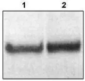 Anti-Dab1 antibody used in Western Blot (WB). GTX16675
