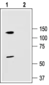 Anti-KCNC3 antibody used in Western Blot (WB). GTX16682