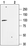 Anti-KCNN3 antibody used in Western Blot (WB). GTX16683