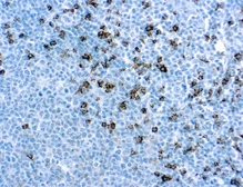 Anti-CD8 antibody [SP16] used in IHC (Paraffin sections) (IHC-P). GTX16696